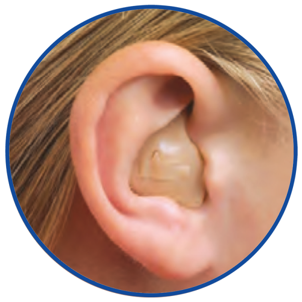 Full_shell_in_the_ear Expert Hearing